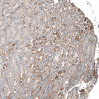 Anti-PLA2G10 Antibody