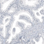 Immunohistochemical staining of human Prostate shows no positivity in glandular cells as expected.