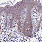 Immunohistochemical staining of human skin shows moderate cytoplasmic positivity in squamous epithelial cells.