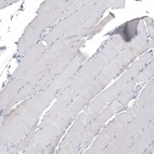 Immunohistochemical staining of human Skeletal muscle shows no positivity in myocytes as expected.