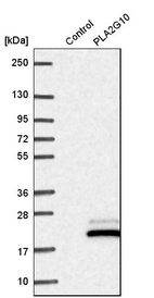 Anti-PLA2G10 Antibody