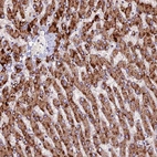 Immunohistochemical staining of human liver shows strong cytoplasmic positivity in hepatocytes.