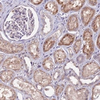 Immunohistochemical staining of human kidney shows moderate cytoplasmic positivity in cells in tubules.