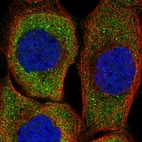 Immunofluorescent staining of human cell line A-431 shows localization to cytosol.