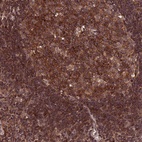 Anti-PKD2L2 Antibody