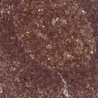 Anti-PKD2L2 Antibody