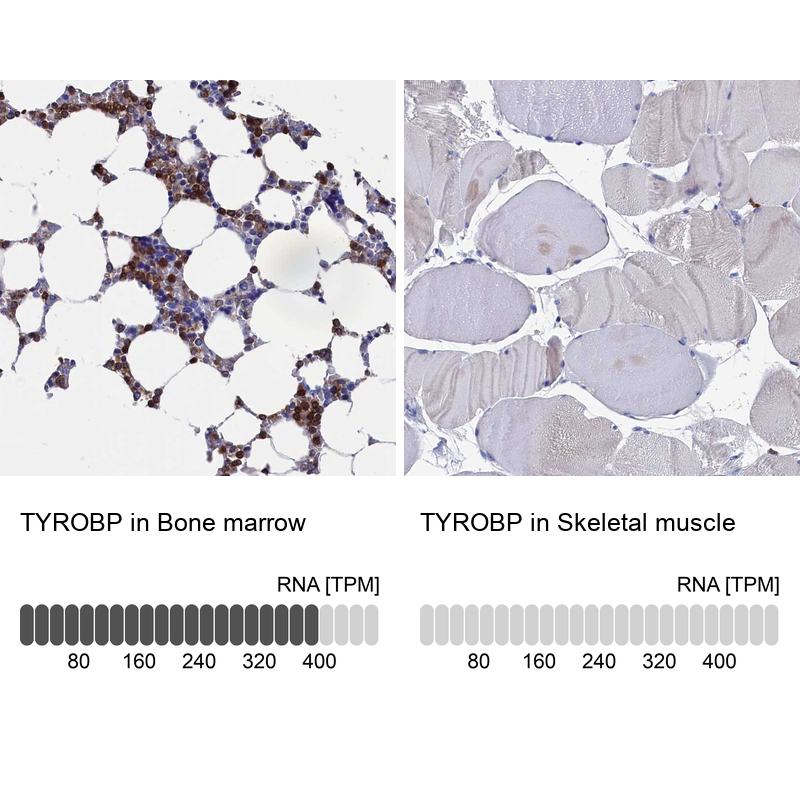 Anti-TYROBP Antibody