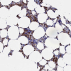 Immunohistochemical staining of human bone marrow shows moderate cytoplasmic positivity in hematopoietic cells.
