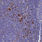 Immunohistochemical staining of human lymph node shows moderate cytoplasmic positivity in non-germinal center cells.