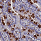 Immunohistochemical staining of human small intestine shows strong cytoplasmic positivity in goblet cells.