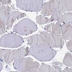 Immunohistochemical staining of human skeletal muscle shows no positivity in myocytes as expected.