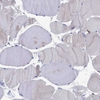 Immunohistochemical staining of human skeletal muscle shows no positivity in myocytes as expected.