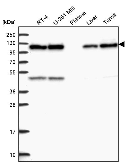 Anti-C15orf39 Antibody