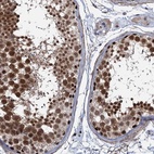 Immunohistochemical staining of human testis shows high expression.