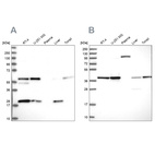 Western blot analysis using Anti-SAE1 antibody HPA041906 (A) shows similar pattern to independent antibody HPA043552 (B).