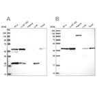 Western blot analysis using Anti-SAE1 antibody HPA041906 (A) shows similar pattern to independent antibody HPA043552 (B).