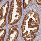 Immunohistochemical staining of human prostate shows moderate cytoplasmic positivity in glandular cells.
