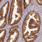 Immunohistochemical staining of human prostate shows moderate cytoplasmic positivity in glandular cells.