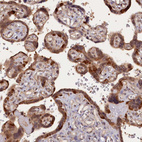 Immunohistochemical staining of human placenta shows moderate cytoplasmic positivity in trophoblastic cells.