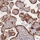 Immunohistochemical staining of human placenta shows moderate cytoplasmic positivity in trophoblastic cells.