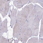 Immunohistochemical staining of human skeletal muscle shows no positivity in myocytes as expected.