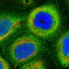 Immunofluorescent staining of human cell line A-431 shows localization to plasma membrane & cytosol.