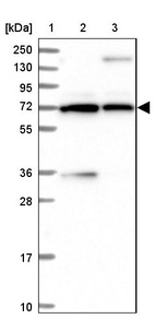 Lane 1: Marker [kDa] 250, 130, 95, 72, 55, 36, 28, 17, 10_br/_Lane 2: Human cell line RT-4_br/_Lane 3: Human cell line U-251MG sp