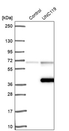 Anti-UNC119 Antibody
