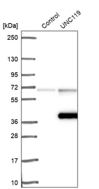 Western blot analysis in control (vector only transfected HEK293T lysate) and UNC119 over-expression lysate (Co-expressed with a C-terminal myc-DDK tag (~3.1 kDa) in mammalian HEK293T cells, LY417490).