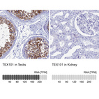 Anti-TEX101 Antibody