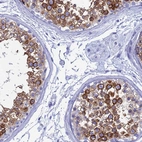 Immunohistochemical staining of human testis shows high expression.