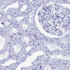 Immunohistochemical staining of human kidney shows low expression as expected.