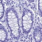 Immunohistochemical staining of human colon using Anti-TEX101 antibody HPA041915.