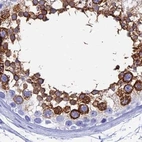 Immunohistochemical staining of human testis using Anti-TEX101 antibody HPA041915.