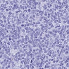 Immunohistochemical staining of human tonsil using Anti-TEX101 antibody HPA041915.