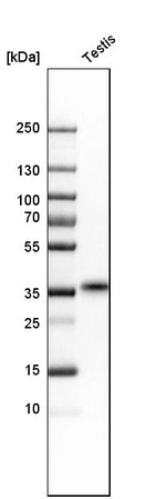 Western blot analysis in human testis tissue.