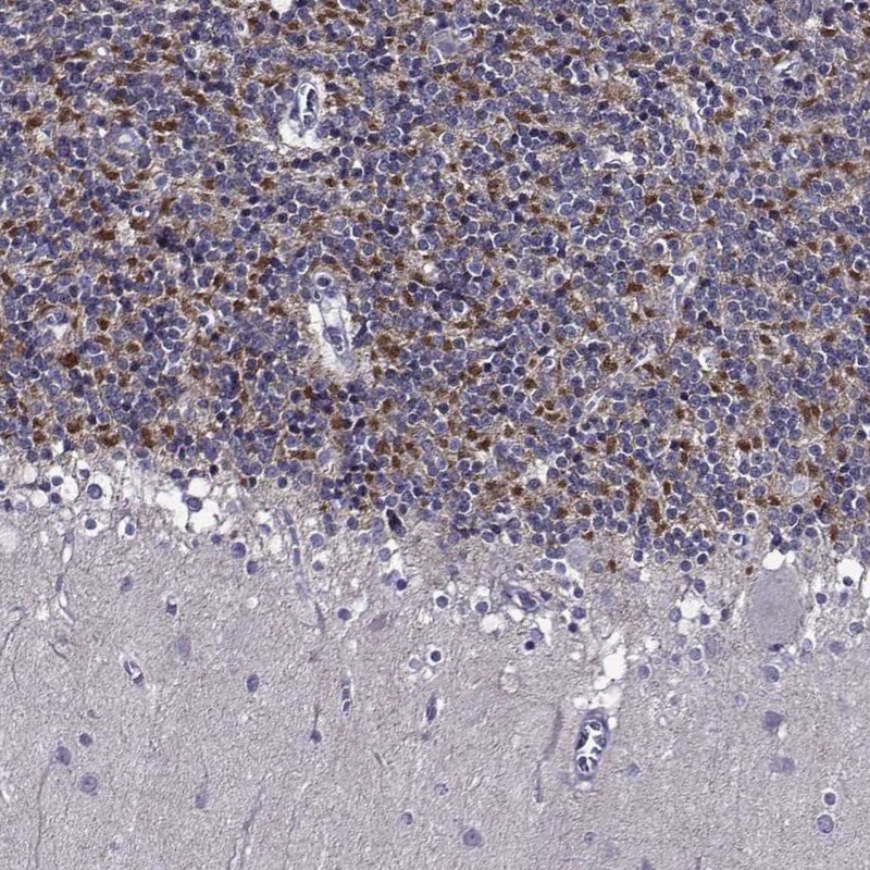 Anti-TMEM266 Antibody