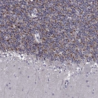 Anti-TMEM266 Antibody