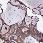 Immunohistochemical staining of human thyroid gland shows strong membranous positivity in glandular cells.