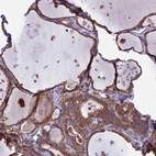 Immunohistochemical staining of human thyroid gland shows strong membranous positivity in glandular cells.