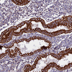 Immunohistochemical staining of human endometrium shows moderate to strong membranous positivity in glandular cells.