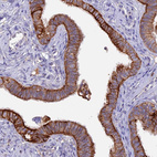 Immunohistochemical staining of human fallopian tube shows moderate to strong membranous positivity in glandular cells.
