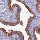 Immunohistochemical staining of human fallopian tube shows moderate to strong membranous positivity in glandular cells.