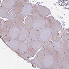 Immunohistochemical staining of human skeletal muscle shows no positivity in myocytes as expected.