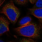 Immunofluorescent staining of human cell line U-2 OS shows localization to vesicles.