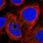 Immunofluorescent staining of human cell line A-431 shows localization to the Golgi apparatus & vesicles.