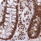 Immunohistochemical staining of human colon using Anti-FAM103A1 antibody HPA041923.