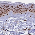 Immunohistochemical staining of human skin using Anti-FAM103A1 antibody HPA041923.