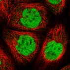 Immunofluorescent staining of human cell line A-431 shows localization to nucleoplasm.