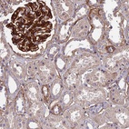 Anti-EVA1B Antibody